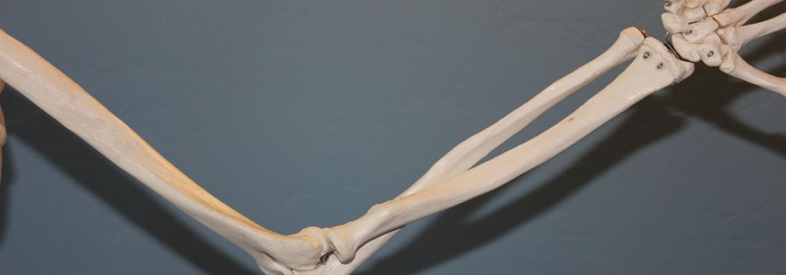 artritis1-1140